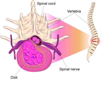 neck and back pain treatment